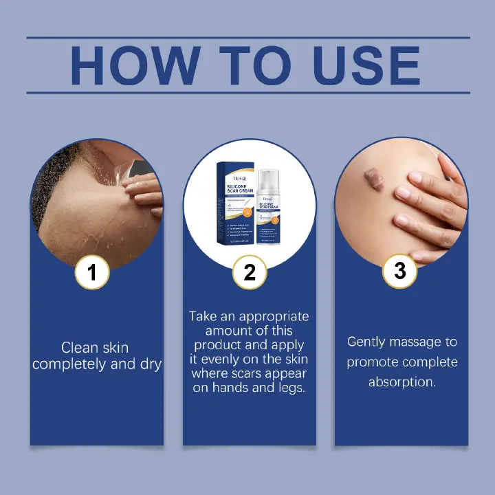 Medical-Grade Silicone Scar Gel for Surgery, C-Section & Keloids | Advanced Scar Cream with Onion Extract | Visibly Minimizes Old & New Scars, Stretch Marks & Bumps