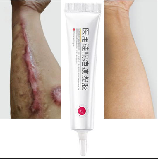 Medical Silicone Scar Gel Scar Cream Burn Burn C-section Scar Removal Cream