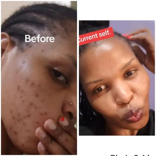 SPEARMINT Organic Leaf Herb for Hormonal Imbalance /Acne/Facial Hairs & PCOS