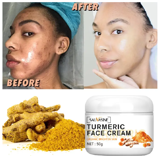 Sauvasine Lanthome TURMERIC Brightening & Anti-Aging Face Cream. Treats Acne, Minimize Pores, Fade Spots & Smoothens