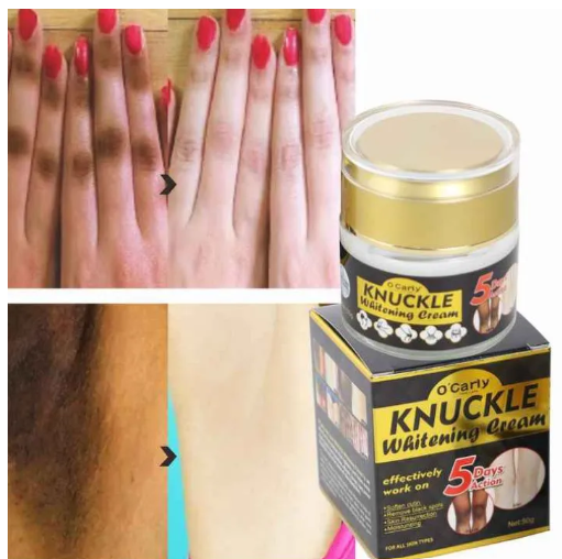 O'Carly Knuckle Whitening Cream. Clears Dark Knuckles Spots Ocarly