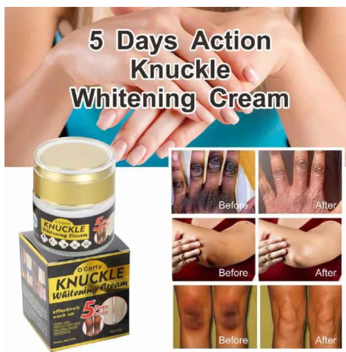 O'Carly Knuckle Whitening Cream. Clears Dark Knuckles Spots Ocarly