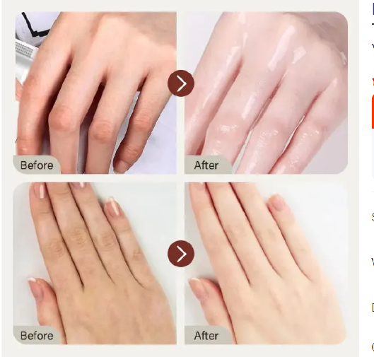 IREV Retinol Hand Cream - with Retinol Gold Collagen - Antiaging Hand Treatment Cream Softens Smoothes Protects Hands Nails Cuticles - For Younger Looking Hands Vitamin A Minimises Age Effect on Skin
