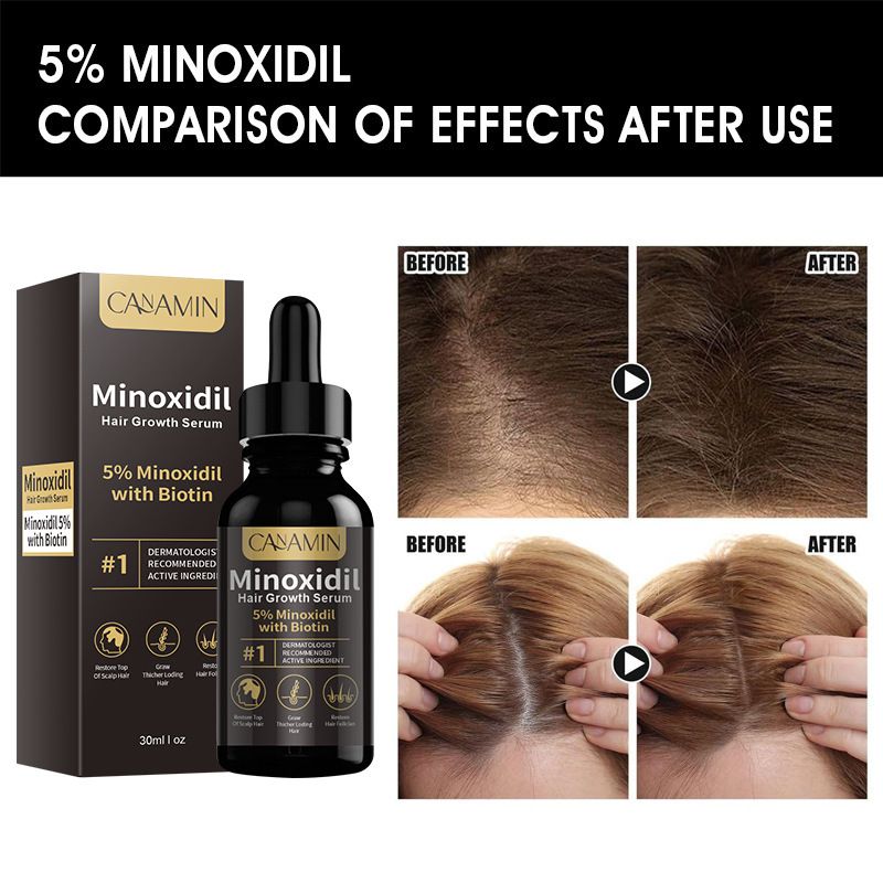Universal Melao 5% Minoxidil 30mlX2 bottles of men's and women's hair growth essence male beard oil to avoid hair loss, vegan and harmless chemicals, biological substances, hair regeneration, natural