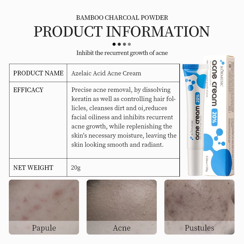 2pcs Gentle Acne-Fighting Facial Care Creams – Moisturizing, Hydrating, Oil-Free Daily Face Cream for Acne, Pimples & Blemishes, Smooth, Soft & Clear Skin