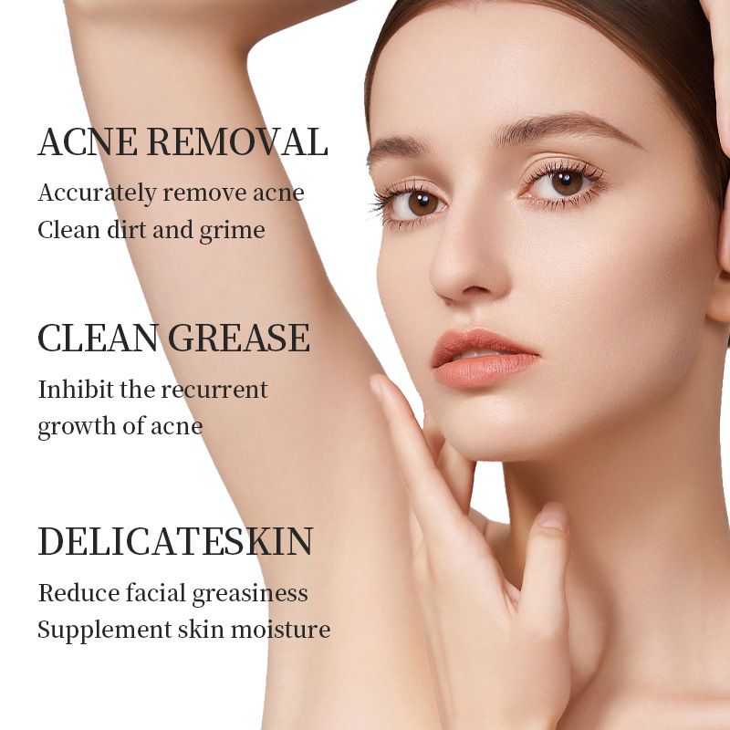 2pcs Gentle Acne-Fighting Facial Care Creams – Moisturizing, Hydrating, Oil-Free Daily Face Cream for Acne, Pimples & Blemishes, Smooth, Soft & Clear Skin