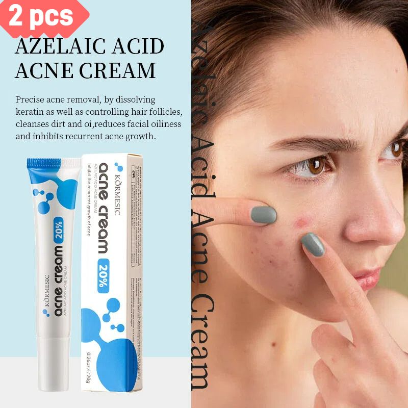 2pcs Gentle Acne-Fighting Facial Care Creams – Moisturizing, Hydrating, Oil-Free Daily Face Cream for Acne, Pimples & Blemishes, Smooth, Soft & Clear Skin