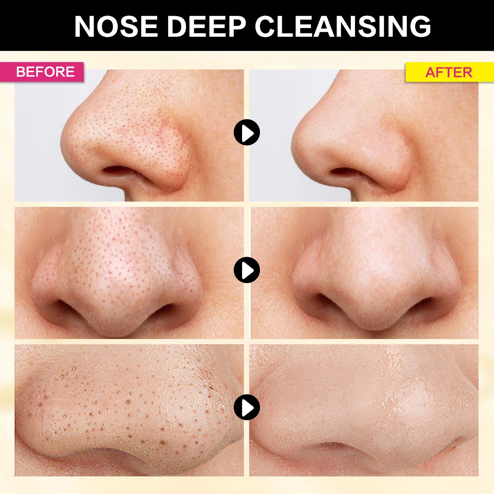 10pcs bamboo charcoal to remove blackheads, nose patches, shrink pores, remove acne, T-zone blackheads, nose patches, pig nose patches