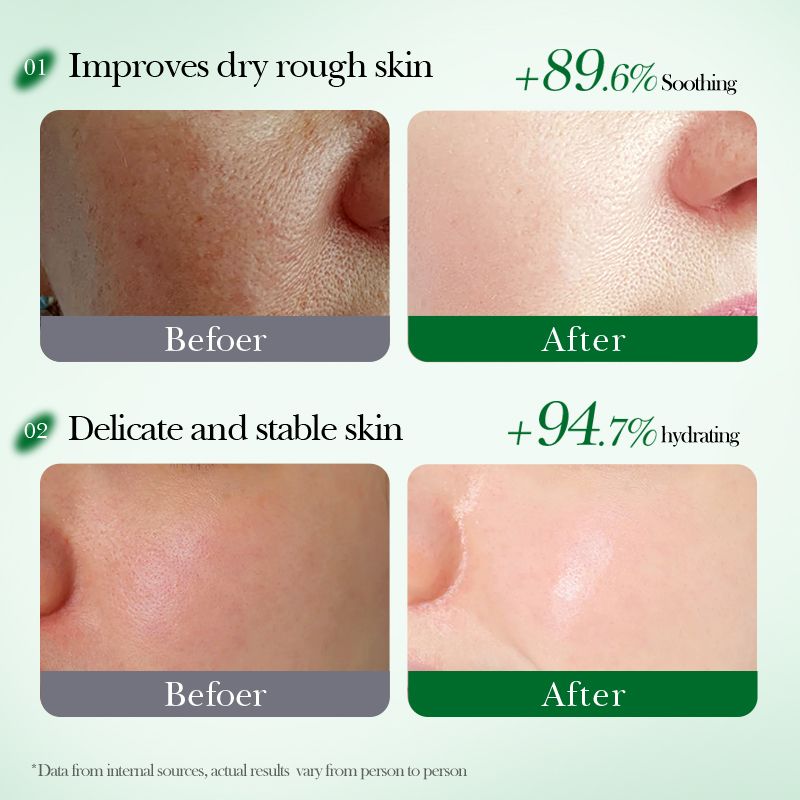 FAYANKOU aloe vera face mask -sadoer skin care set natural plants - moisturize hydrating brightening whitening acne treatment | firming anti-wrinkle deeply nourish smooth anti-dark repair skin