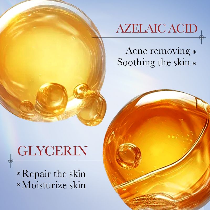 SADOER Salicylic Acid Acne Cream Salicylic Acid Anti-Acne Cream Niacinamide Acne Treatment Ceramide Treat Acne Reduce Pimple Fade Acne Scar Fade Dark Spot Hydrating Moisturizing Oil Control