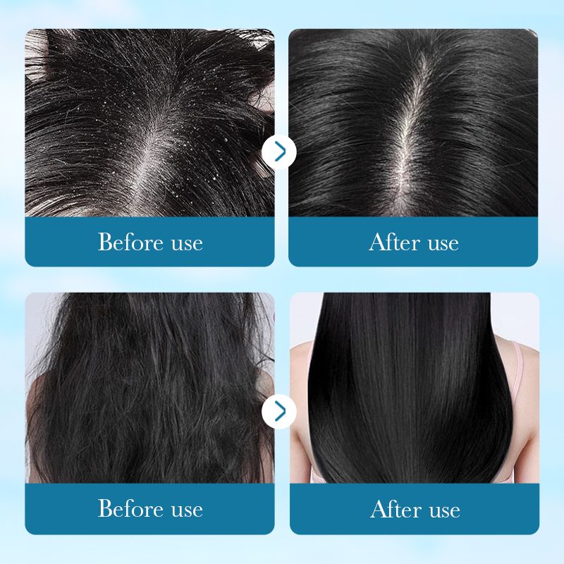 SADOER Natural Aloe Vera Shampoo Anti-Dandruff Shampoo Disposable Hair Repair Shampoo Sachet Aloe Extract Keratin Vitamin E Moisturizing Nourishing Dry Hair Oily Scalp Frizzy Hair Budget-Friendly