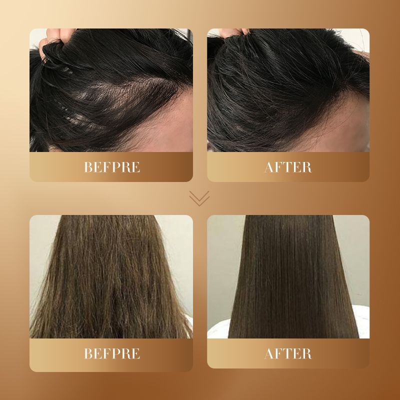 Natural Ginger Essence Disposable Shampoo Anti-Dandruff Oil Control Deep Cleansing Hair Strengthening Volumizing Ginger Extract Biotin Keratin Strengthens Hair Roots Repairs Dry Ends Soft & Silky