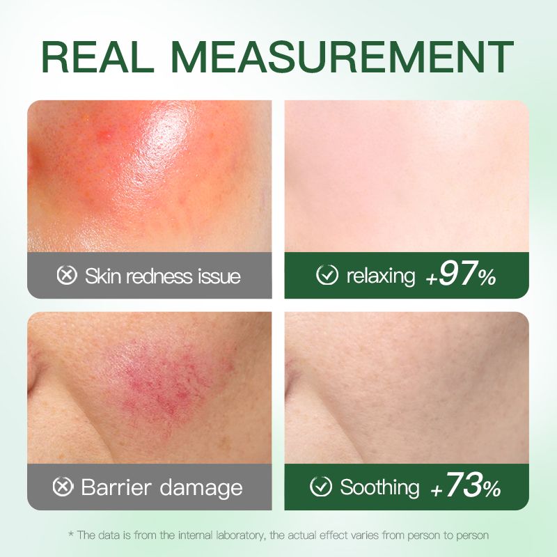 SADOER aloe vera face mask -sadoer skin care set natural plants - moisturize hydrating brightening whitening acne treatment | firming anti-wrinkle deeply nourish smooth anti-dark repair skin