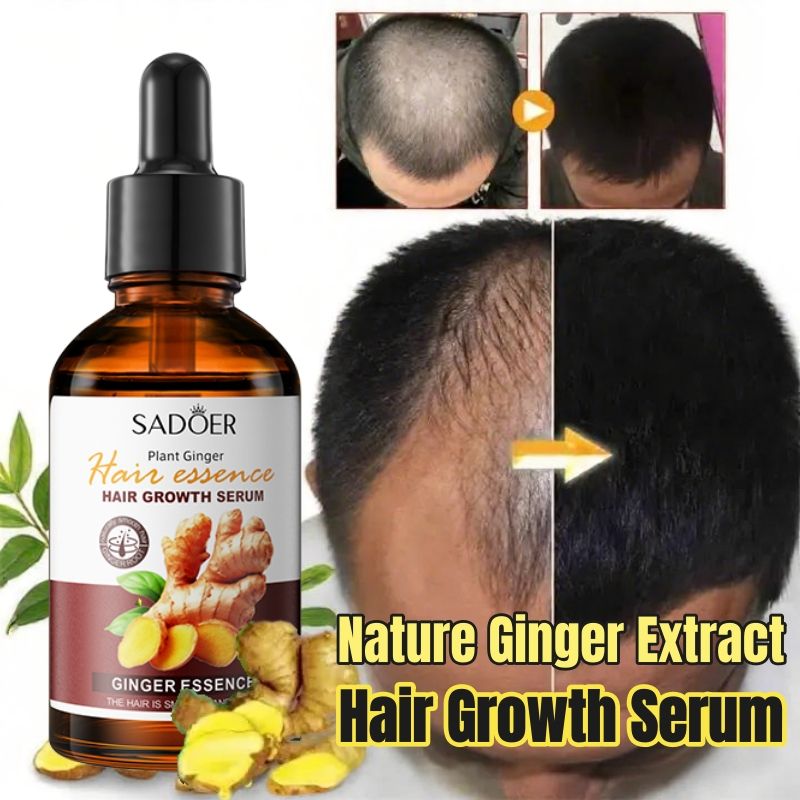 SADOER Nature Ginger Essence Hair Growth Oil Hair Growth Serum Hair Strengthening Treatment Scalp Treatment Promotes Hair Growth Thins Hair Solution Reduces Hair Breakage Strengthens Hair Roots