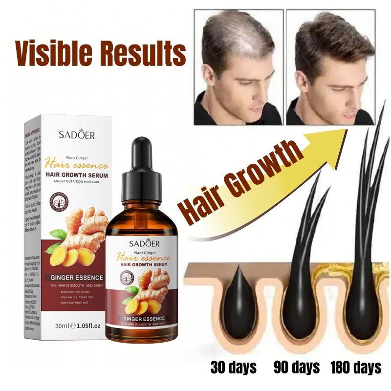 SADOER Nature Ginger Essence Hair Growth Oil Hair Growth Serum Hair Strengthening Treatment Scalp Treatment Promotes Hair Growth Thins Hair Solution Reduces Hair Breakage Strengthens Hair Roots
