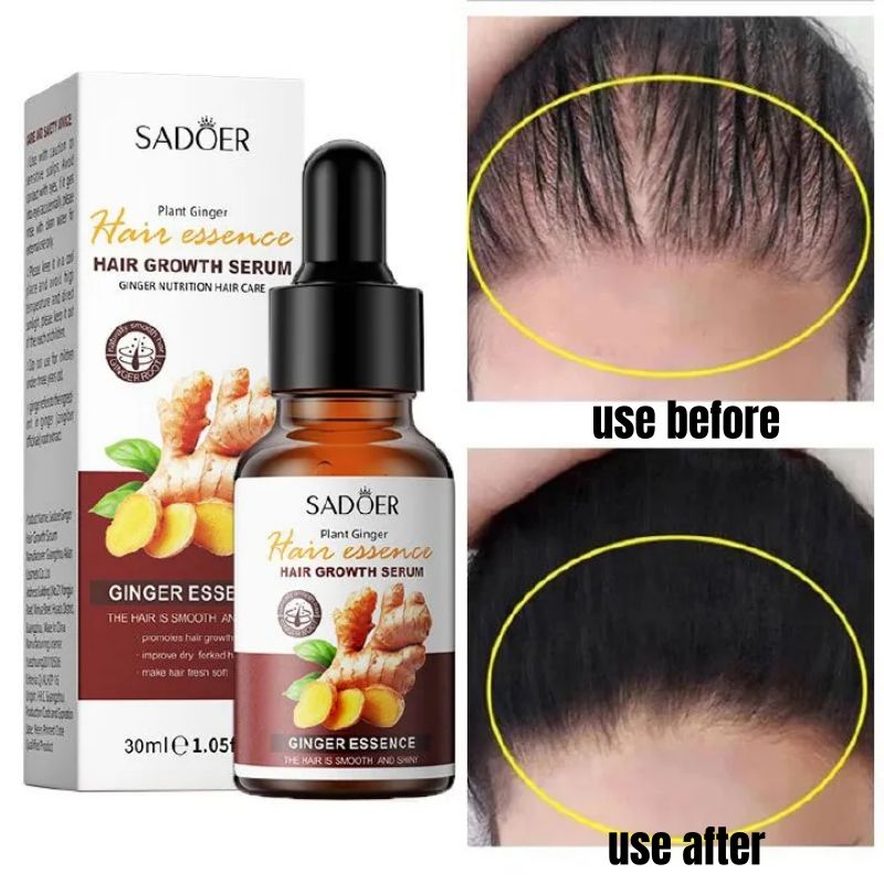 SADOER Nature Ginger Essence Hair Growth Oil Hair Growth Serum Hair Strengthening Treatment Scalp Treatment Promotes Hair Growth Thins Hair Solution Reduces Hair Breakage Strengthens Hair Roots