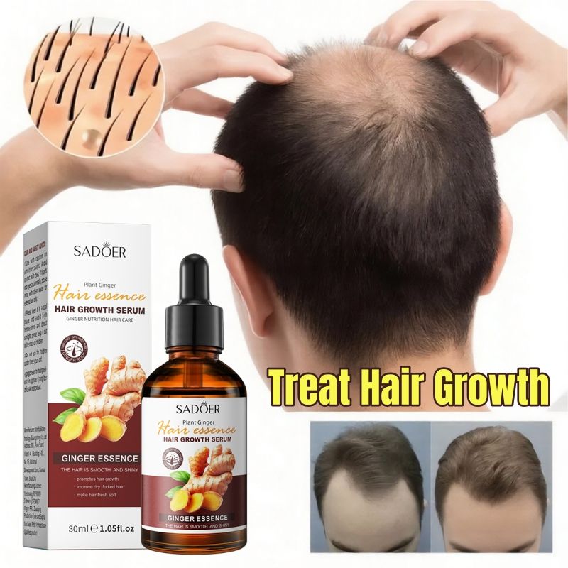 SADOER Nature Ginger Essence Hair Growth Oil Hair Growth Serum Hair Strengthening Treatment Scalp Treatment Promotes Hair Growth Thins Hair Solution Reduces Hair Breakage Strengthens Hair Roots