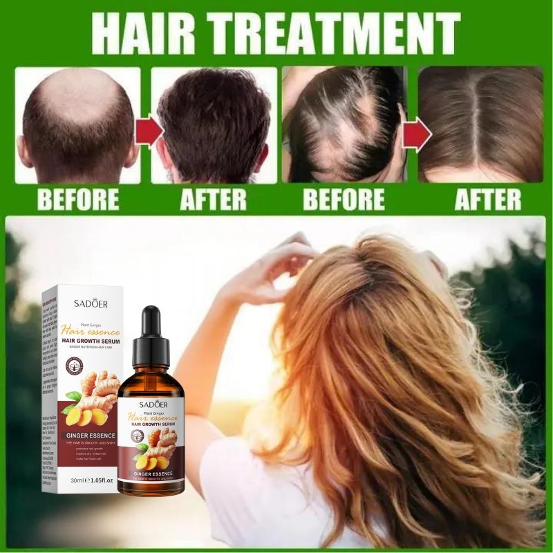 SADOER Nature Ginger Essence Hair Growth Oil Hair Growth Serum Hair Strengthening Treatment Scalp Treatment Promotes Hair Growth Thins Hair Solution Reduces Hair Breakage Strengthens Hair Roots
