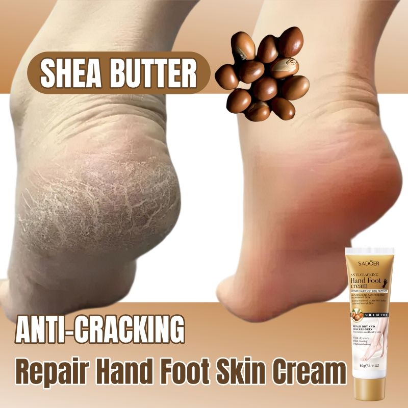 SADOER Anti-Crack  Foot Cream & Hand Cream Shea Butter Cracked Heel Cream Dry Skin Repair Cream Cracked Skin Repair Deep Moisturizing Nourishing Hydrating Softening Restores Dry Skin 24h Hydration