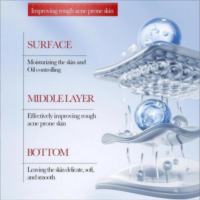 SADOER Salicylic Acid Acne Cream Salicylic Acid Anti-Acne Cream Niacinamide Acne Treatment Ceramide Treat Acne Reduce Pimple Fade Acne Scar Fade Dark Spot Hydrating Moisturizing Oil Control