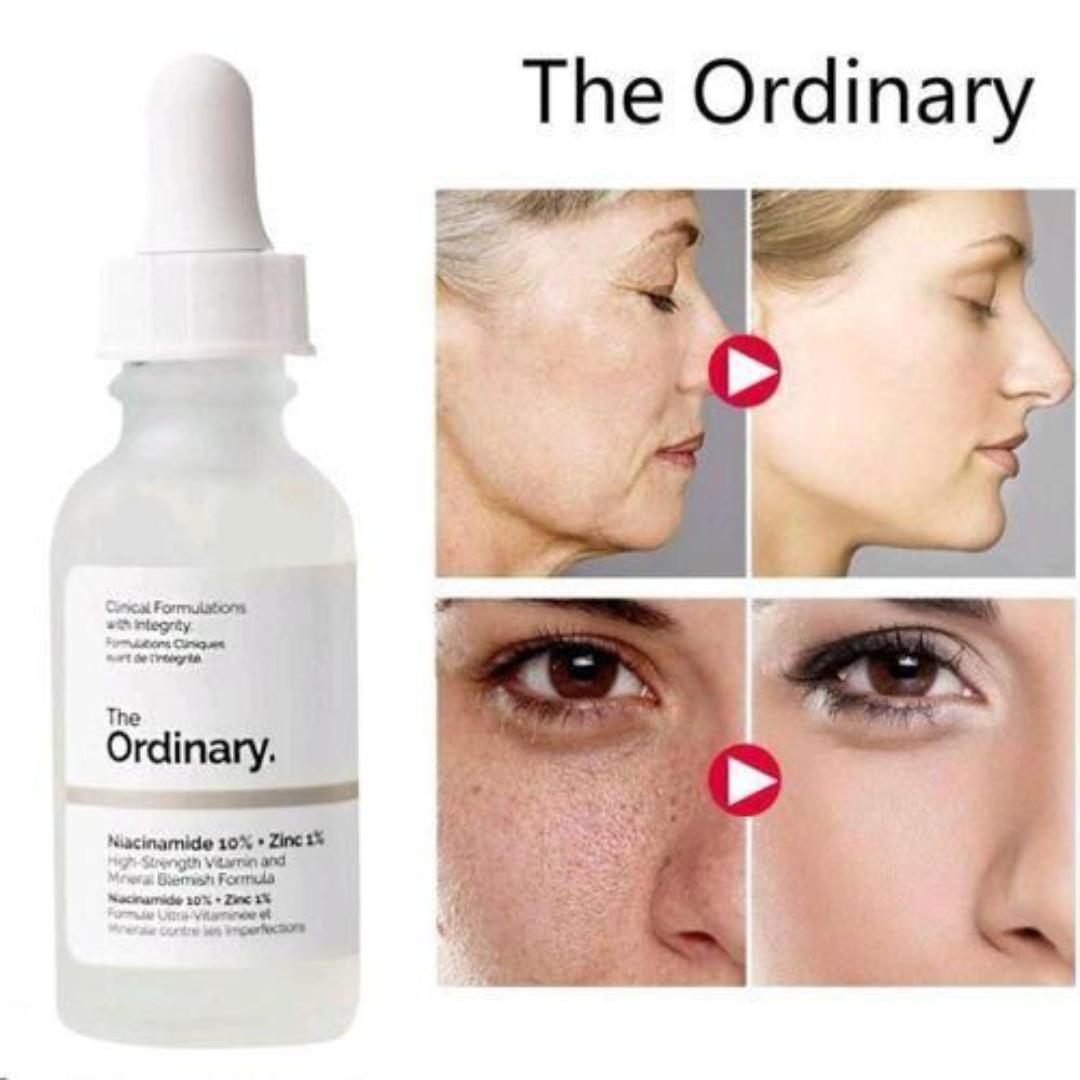 Niacinamide 10% + Zinc 1% Fine, Reduces congestion while also brightening skin tone, Zinc to balance visible aspects of sebum activity