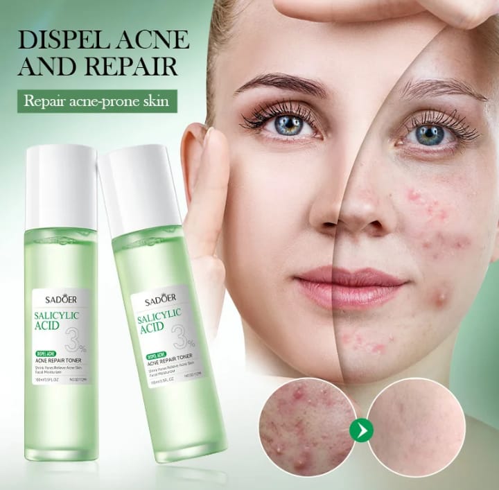 ACNE SKIN CARE TREATMENT _SADOER TONER +SADOER SERUM+ALOE VERA GEL+ASANTEE GOAT AND TAMARIND SOAP. THIS SKIN CARE SET WILL DRY UP ACNE AND PIMPLES , UNCLOG PORES, AND CONTROL OIL ON ACNE PRONE SKIN