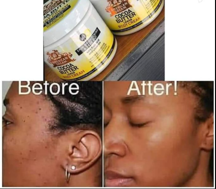 Original American dream cocoa butter, cocoa butter lemon cream, whitening cream, dark spot removal cream, skin brightening cream, moisturizing body cream, face and body cream, lemon whitening cream