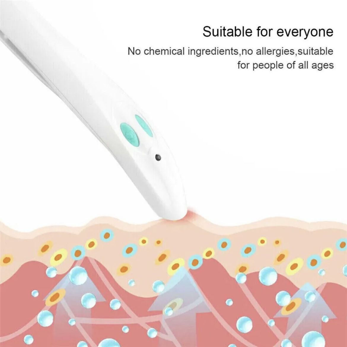 New portable physical anti-itch pen for mosquito bites for adults and children, mosquito bite anti-itch device