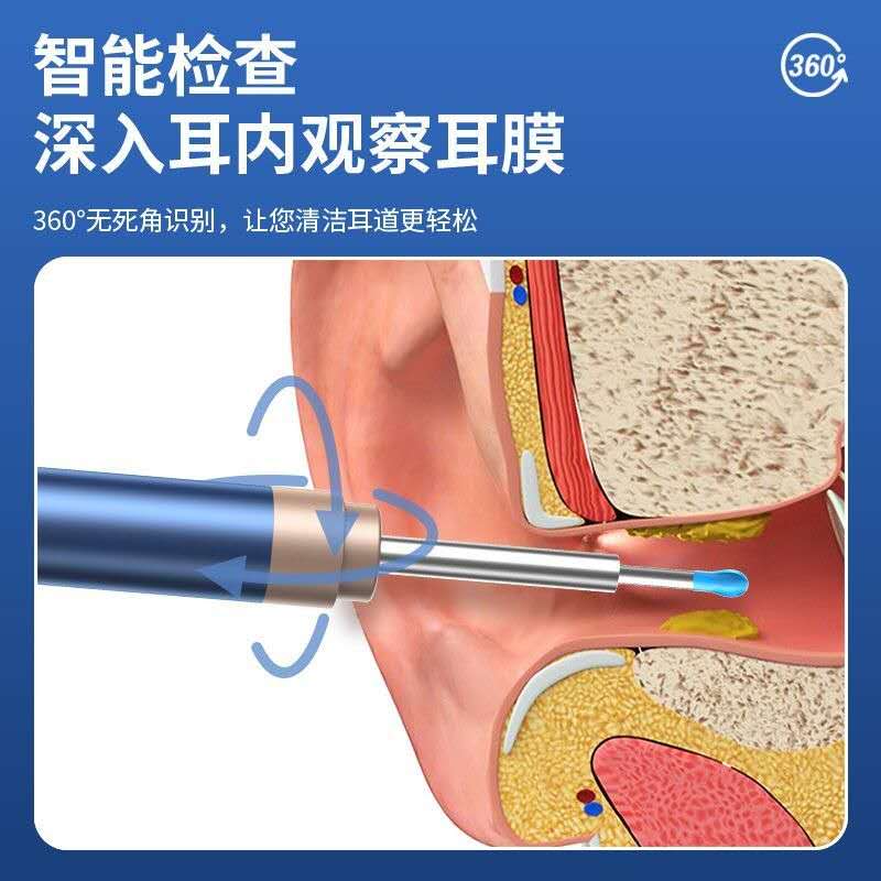 Ear Wax Removal - Earwax Remover Tool - Ear Canal Cleaner with 1080P Camera - FSA HSA Eligible - Ear Cleaning Kit - Ear Camera for iOS & Android black as picture