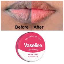 Vaseline Lip Therapy Rosy Lips Balm – 20g. A deeply moisturizing lip balm designed to soften, smooth, and enhance the natural pink tone of your lips. Contains almond oil to soothe and nourish delicate