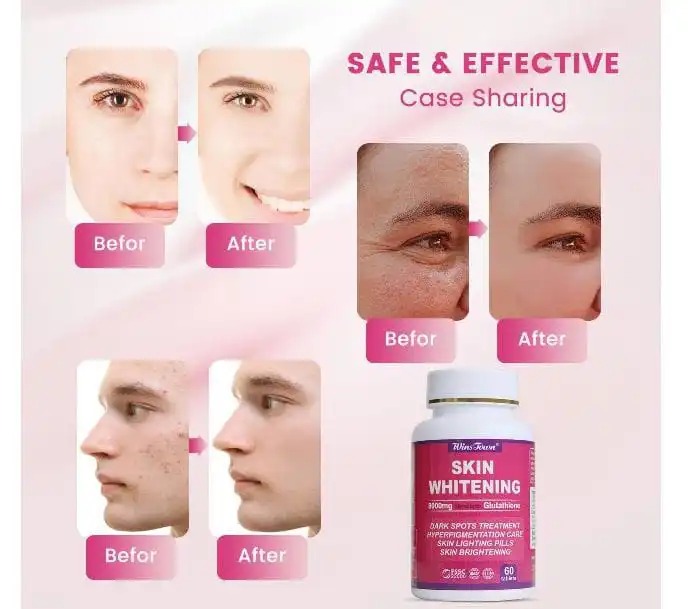 Daynee Skin Whitening Capsules Clears Dark Spot Glutathione Whitening Dark Spots & Acne Scar Remover - 5000g - Made in USA - Vegan Skin Bleaching with Anti-Aging & Antioxidant Effect