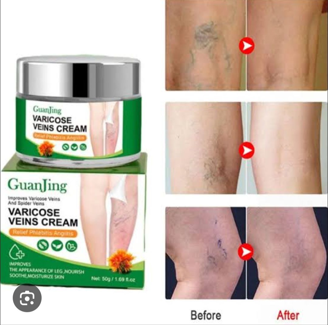 GuanJing Varicose Veins Cream
