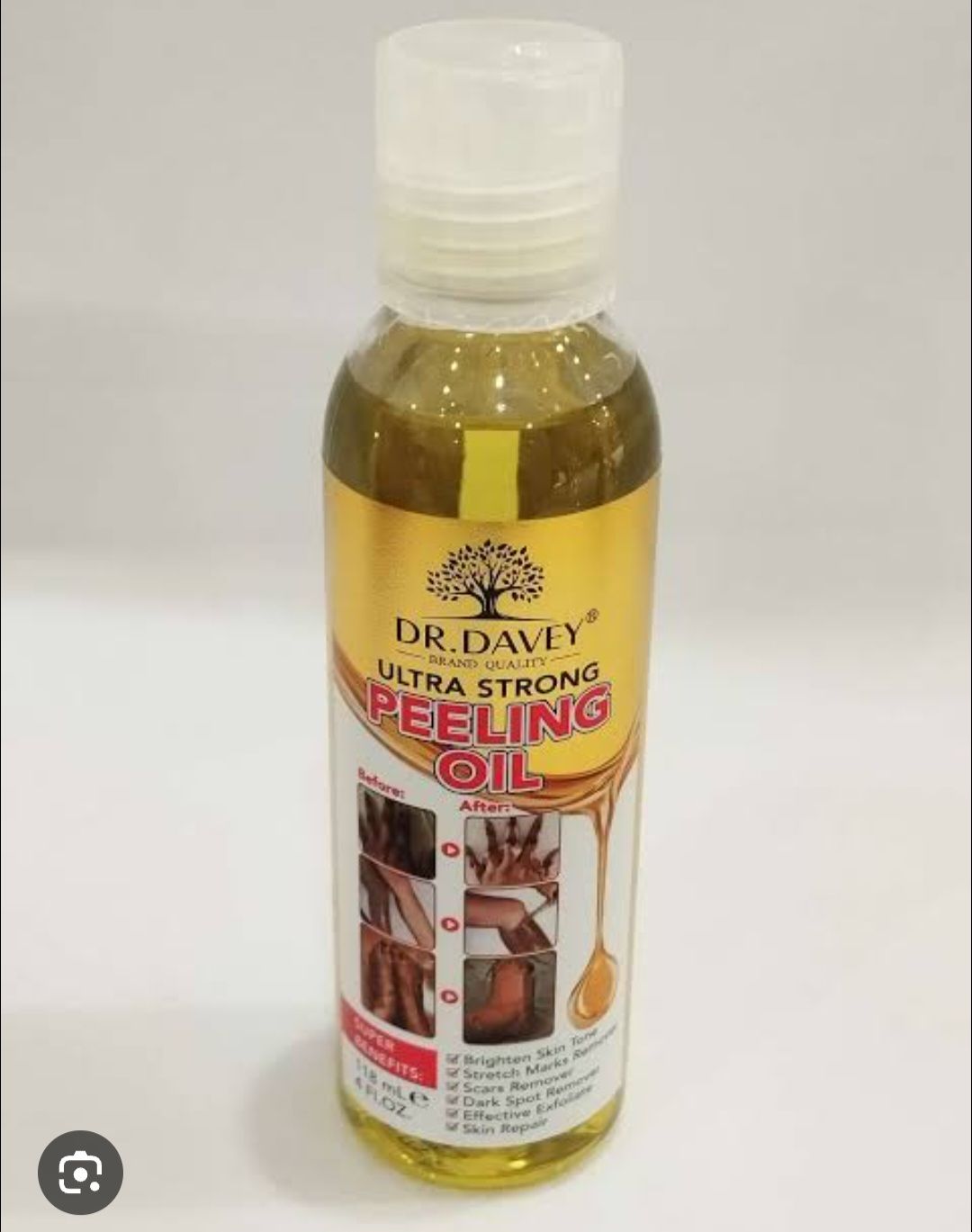 Dr. Davey Ultra Strong Peeling Oil designed to peel away dead skin to reveal smoother, brighter skin.Formulated to brighten skin tone, remove dark spots, and help with stretch marks.