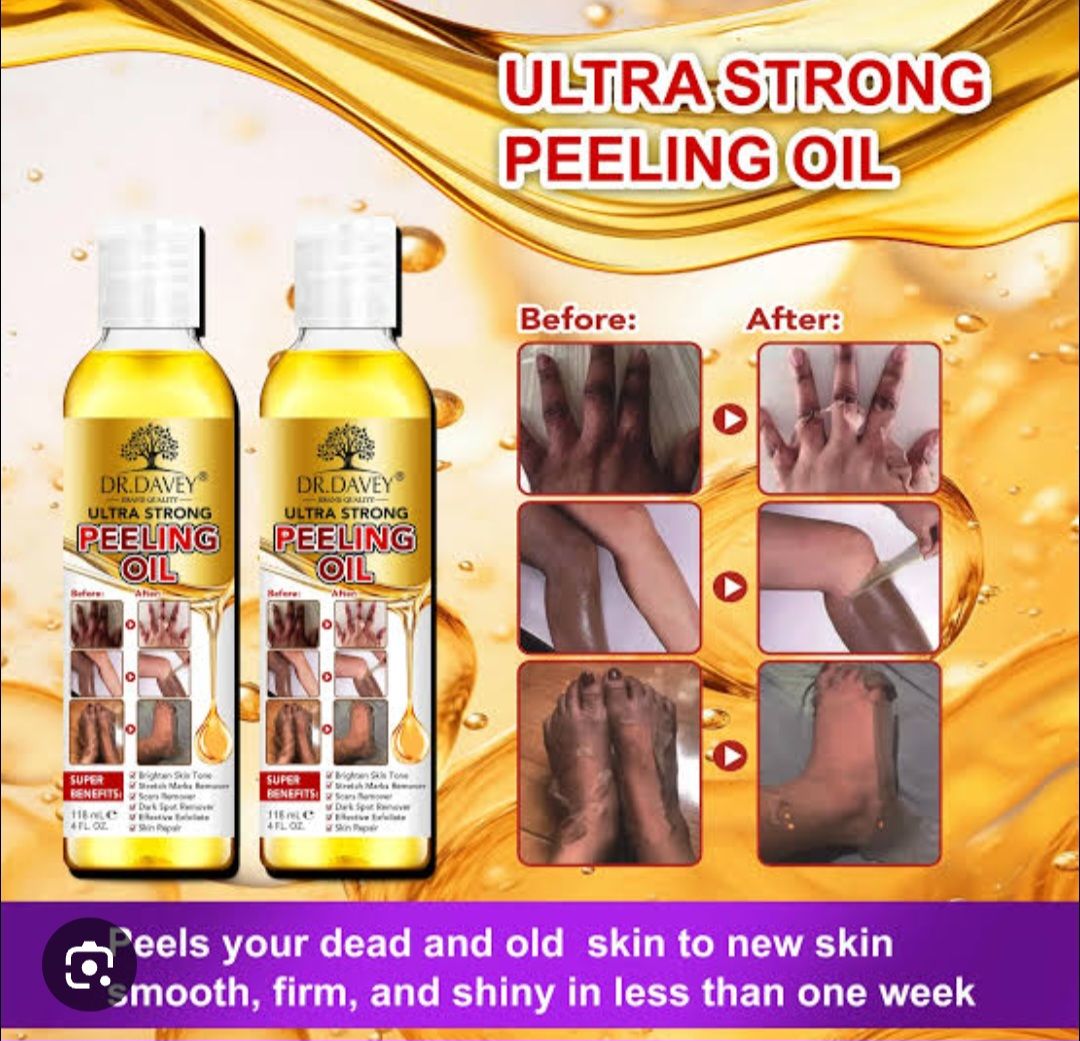 Dr. Davey Ultra Strong Peeling Oil designed to peel away dead skin to reveal smoother, brighter skin.Formulated to brighten skin tone, remove dark spots, and help with stretch marks.