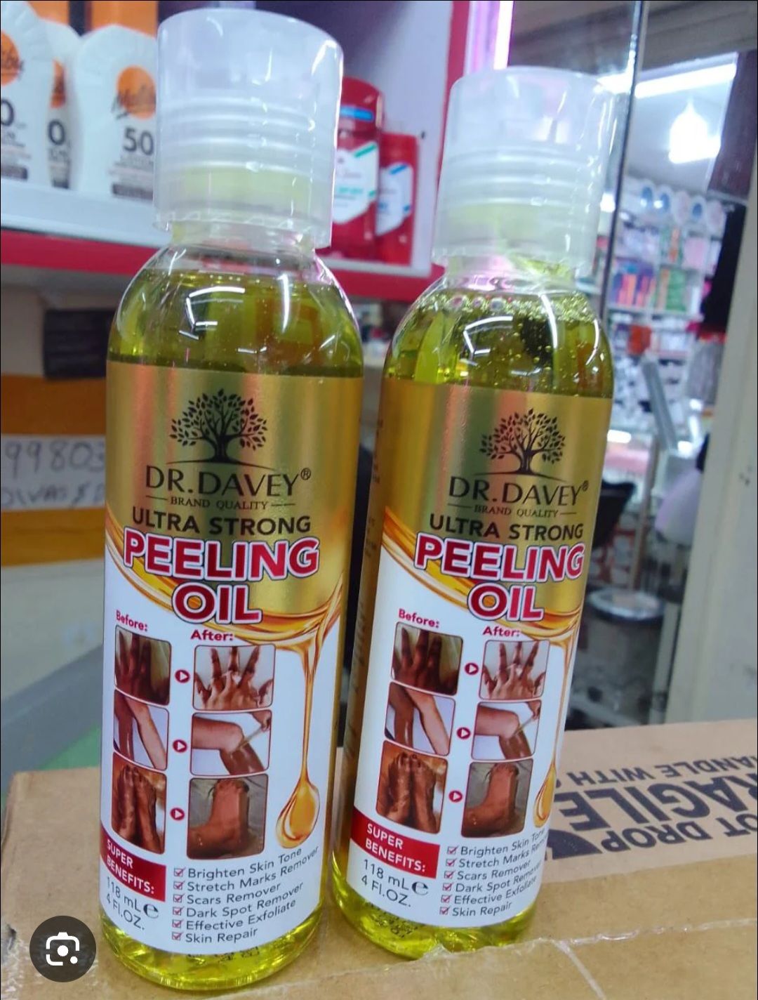 Dr. Davey Ultra Strong Peeling Oil designed to peel away dead skin to reveal smoother, brighter skin.Formulated to brighten skin tone, remove dark spots, and help with stretch marks.