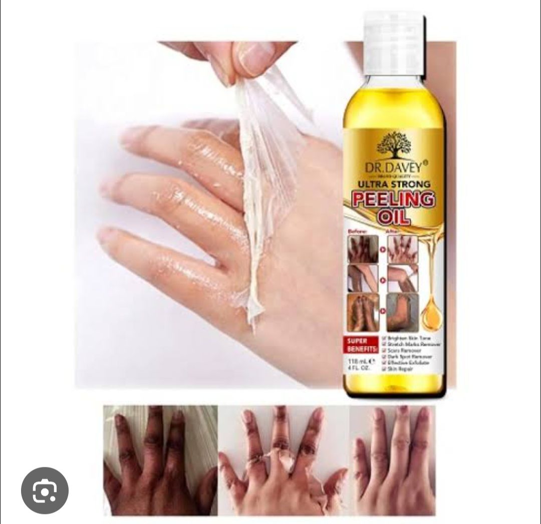 Dr. Davey Ultra Strong Peeling Oil designed to peel away dead skin to reveal smoother, brighter skin.Formulated to brighten skin tone, remove dark spots, and help with stretch marks.