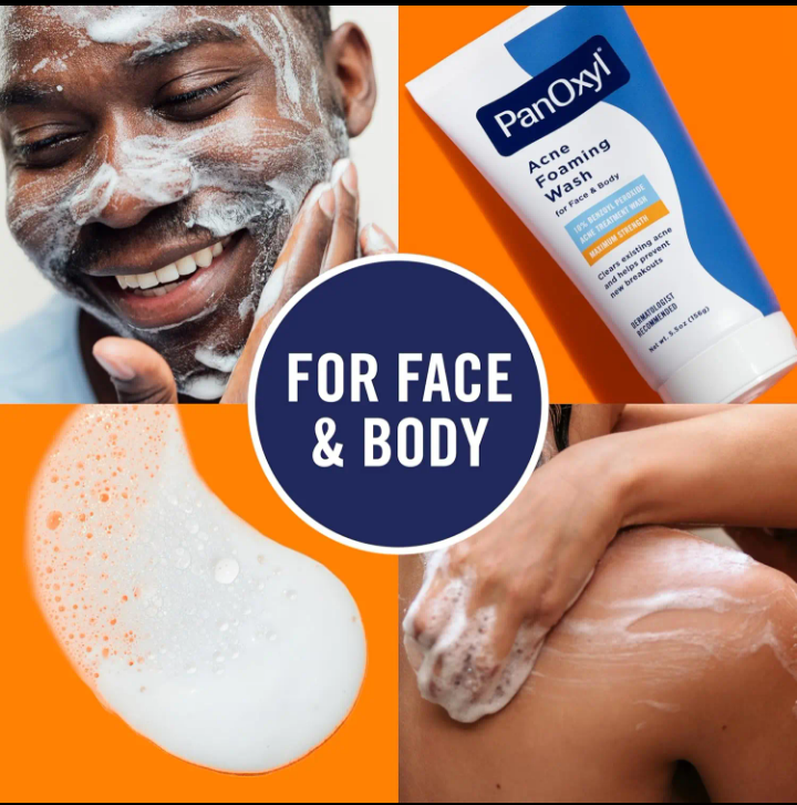 PanOxyl Acne Creamy Wash 4% Benzoyl Peroxide Face & Body Cleanser – Clears Acne & Prevents