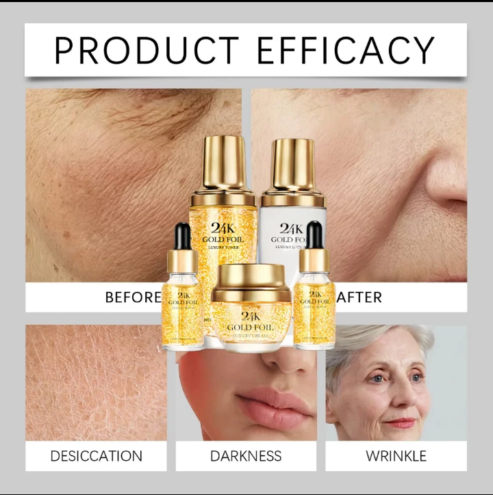 24K Gold Foil Luxury 5‑Gift Set: Toner, Serum, Lotion & Cream. Whitens, moisturizes & firms with Vitamin C, Niacinamide, Hyaluronic Acid & Retinol. Boosts radiance & smooths skin.