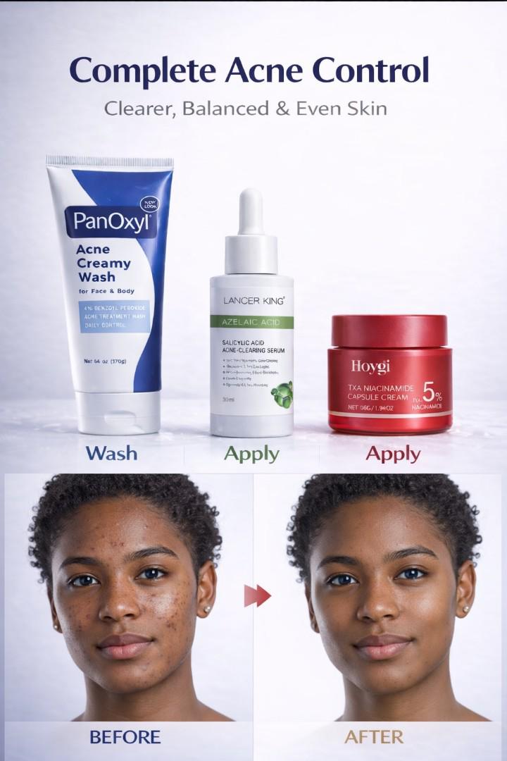 Ultimate Clear Skin Complete Acne Treatment – 4% Benzoyl Peroxide Wash + Azelaic/Salicylic Serum + TXA 5% Niacinamide Cream