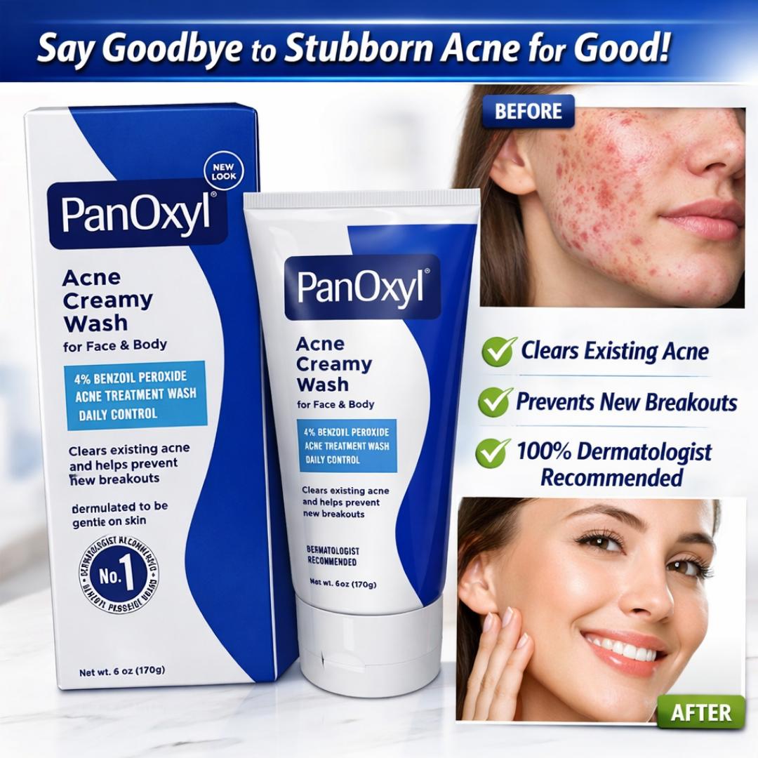 PanOxyl Acne Creamy Wash 4% Benzoyl Peroxide Face & Body Cleanser – Clears Acne & Prevents