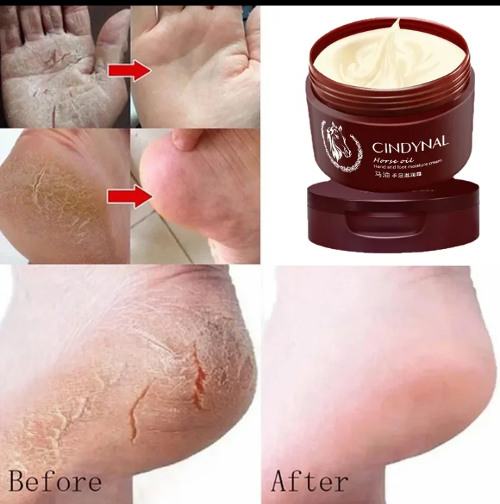 CINDYNAL Horse Oil Deep Repair Hand & Foot Moisturizing Cream for Dry Cracked Heels Skin Repair Nourishing Foot Care Balm