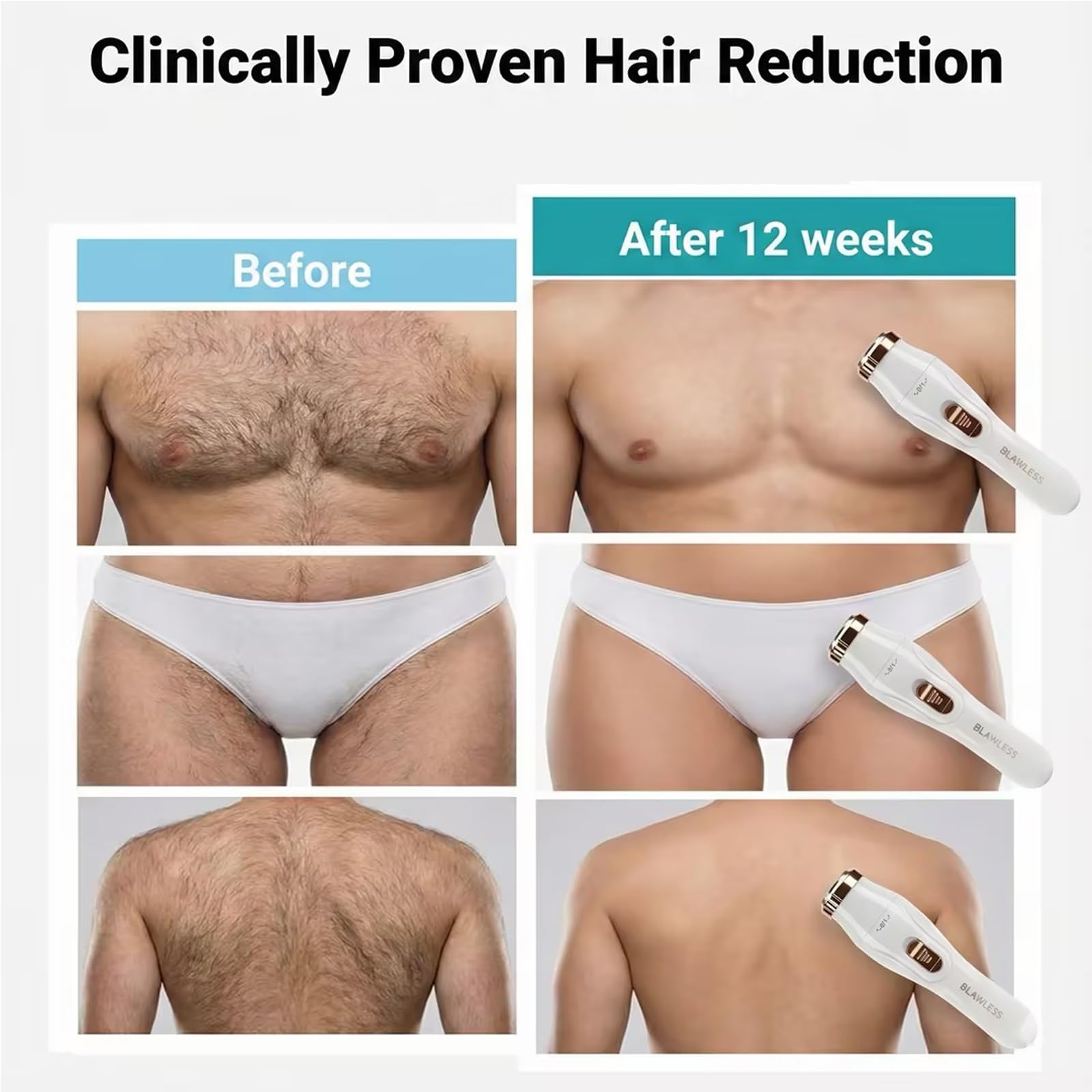 3-in-1 Electric Body Hair Trimmer, White, Ceramic Blades, Wet and Dry Use, USB Rechargeable, Double-Headed Shaver with Nose Ear Trimmer