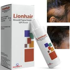 LIONHAIR(minoxidil topical solution usp 5% w/v).