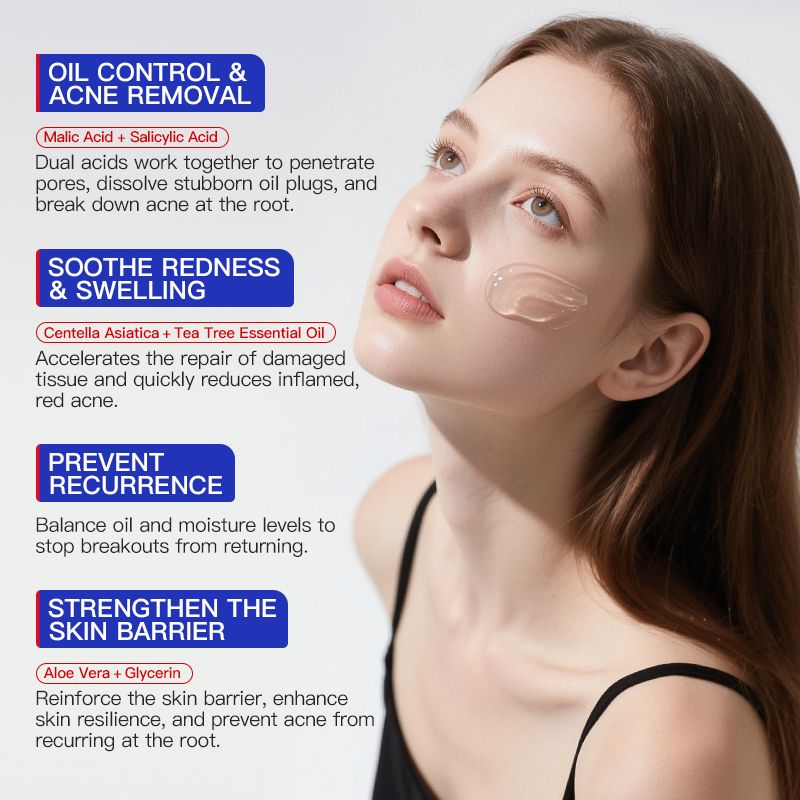 KORMESIC Salicylic Acid Acne Cream Arbutin Acne Treatment Cream Centella Asiatica Anti-Acne Cream Gently Reduces Redness Unclogs Pores Controls Oil Fades Dark Spots Smooth Clear Skin - Acne Prone Skin