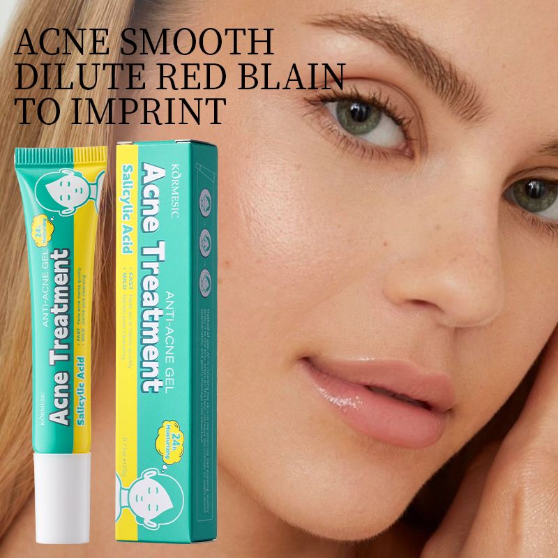 KORMESIC Salicylic Acid Acne Cream Arbutin Acne Treatment Cream Centella Asiatica Anti-Acne Cream Gently Reduces Redness Unclogs Pores Controls Oil Fades Dark Spots Smooth Clear Skin - Acne Prone Skin