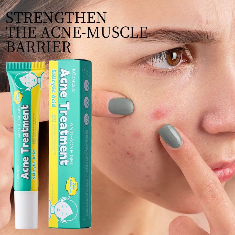 KORMESIC Salicylic Acid Acne Cream Arbutin Acne Treatment Cream Centella Asiatica Anti-Acne Cream Gently Reduces Redness Unclogs Pores Controls Oil Fades Dark Spots Smooth Clear Skin - Acne Prone Skin