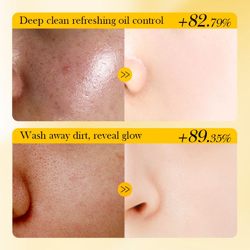 2pcs SADOR Banana Face Wash Facial Cleanser Foam Facial cleanser Foam Cleanser Skin Care Face Cleanser Amino Acid Brightening Oil Control Deep Pore Cleanser Sensitive Skin Ph Balanced Natural Skincare