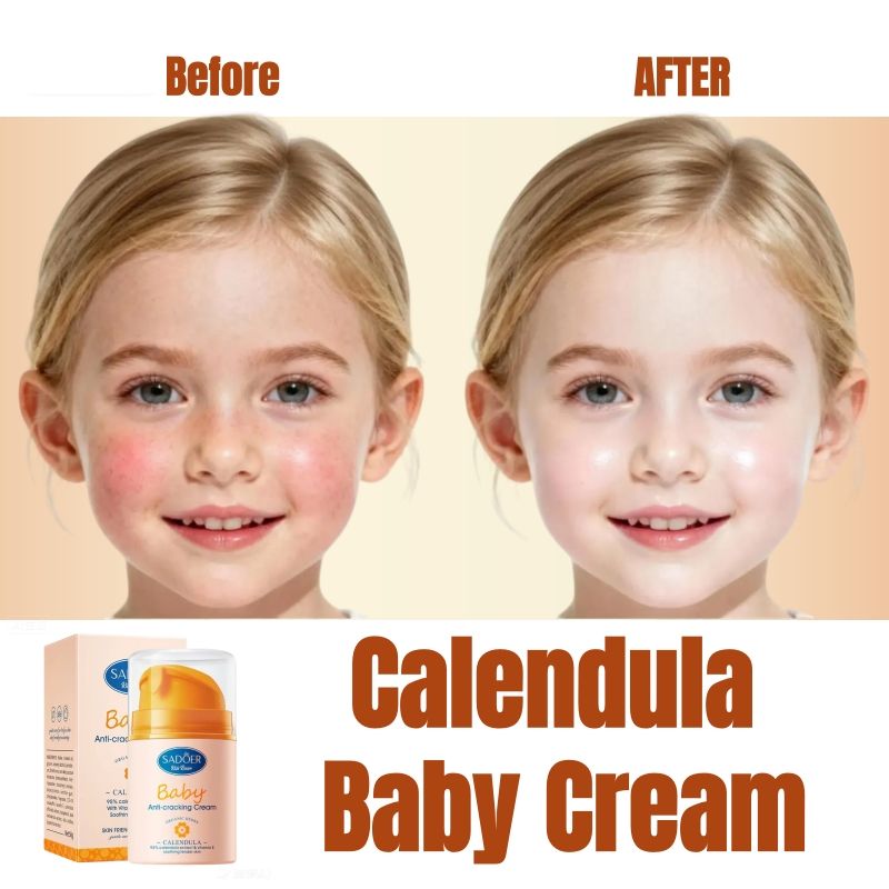Calendula Baby Cream Sadoer Skin Care Set Sooth Tender Skin Child Skincare Child Cream Face Cream Vitamin E Moisturise Anti-crack Body Cream Prevent Redness Cracking Sooth Care Delicate Soft Smooth