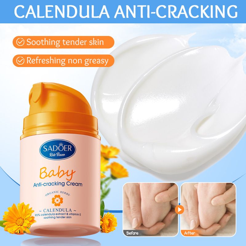 Calendula Baby Cream Sadoer Skin Care Set Sooth Tender Skin Child Skincare Child Cream Face Cream Vitamin E Moisturise Anti-crack Body Cream Prevent Redness Cracking Sooth Care Delicate Soft Smooth