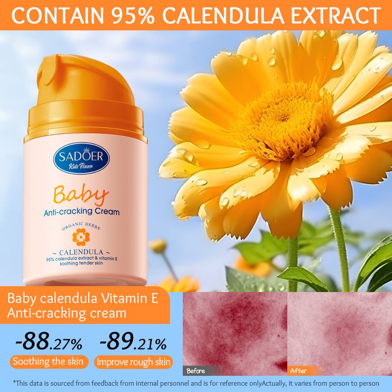 Calendula Baby Cream Sadoer Skin Care Set Sooth Tender Skin Child Skincare Child Cream Face Cream Vitamin E Moisturise Anti-crack Body Cream Prevent Redness Cracking Sooth Care Delicate Soft Smooth
